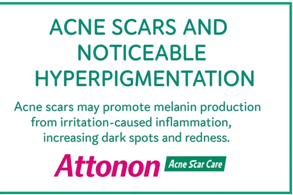 Atnon Acne Care Gel 10gm